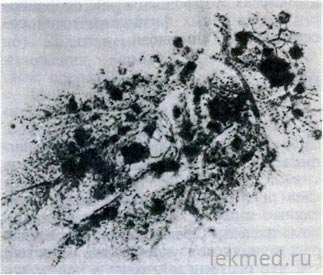 Pancreas - sisteme corporale (histologie)