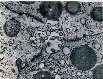 Pancreas - sisteme corporale (histologie)