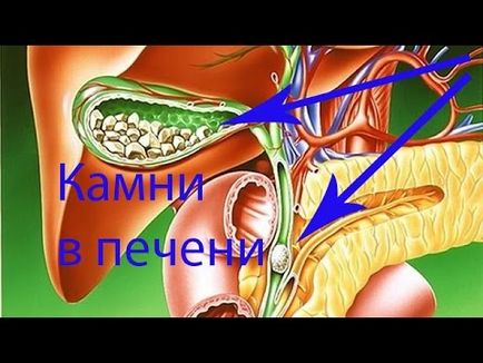 Користь кефіру для печінки чистка з гречкою і інші корисні властивості