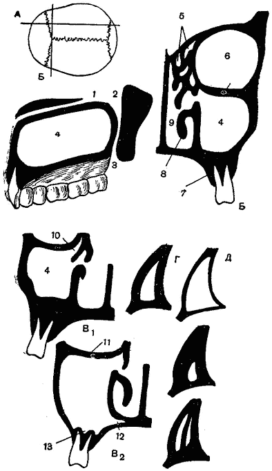 Sinusurile nasului, anatomia topografică a părții faciale a capului