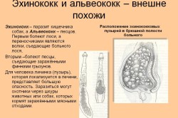 Semne de paraziți în simptomele organismului uman, diagnostic și tratament (foto și video)