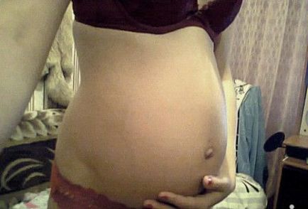 Пупок при вагітності (болить, тягне, коліт, свербить, випирає) чому це відбувається і що робити