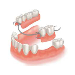 Знімне протезування протипоказання і рекомендації до застосування