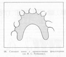 Proteze anticorpi și proteze, periodontită și parodontită, tratamentul bolilor parodontale