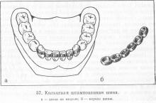 Proteze anticorpi și proteze, periodontită și parodontită, tratamentul bolilor parodontale