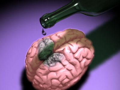 Toxic materia alba a creierului