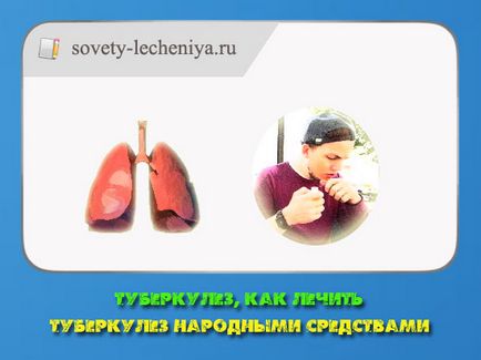 Tuberculoza, cum să tratați tuberculoza cu remedii folclorice