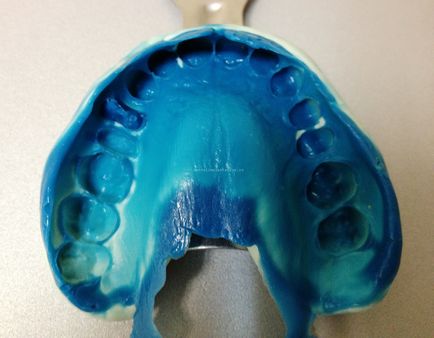 Видаляти або відновлювати, стоматологічна практика доктора федотова в