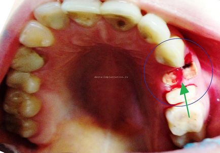 Pentru a elimina sau a restabili, practica dentară a doctorului Fedotov în