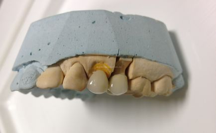Pentru a elimina sau a restabili, practica dentară a doctorului Fedotov în