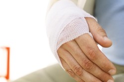 Dislocarea simptomelor durerii de mână și a tratamentului