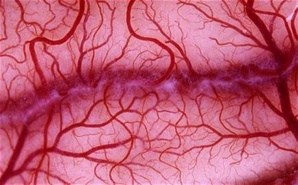 Inflamația vaselor din ochi, creier și membre