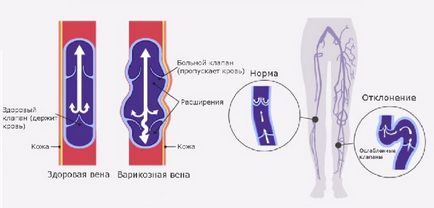 Лікар по судинах і венах як називається і до кого звертатися