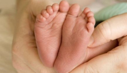 Platypodia congenitală a cauzei, tratamentul, probabilitatea transmiterii ereditare