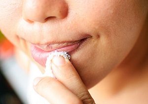Хейліт на губах фото алергічної форми захворювання і способи лікування
