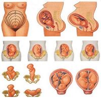 24 Săptămâna poziției fetale, prezentarea fetală