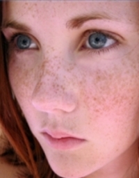 5 tipp a bőr regenerálódását, hogyan kell csalni kor