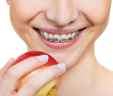 Art Smile - Clinica de implantare dentară în Novosibirsk