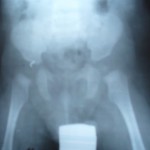 Bioinformatica organelor pierdute, modul de cunoaștere (folosind regenerarea MSEI) Bioinformația organelor pierdute, modul de cunoaștere