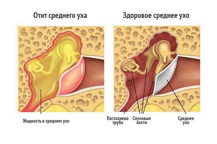 Durerea în simptomele urechii, diagnosticul și metodele de tratament, consultație gratuită la clinica haretelor medicului