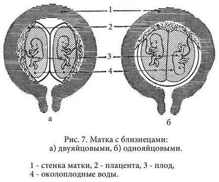 Що потрібно з'їсти, щоб народити двійню