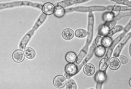 Dysbiosis, szájpenész, elég, hogy fáj - Portál az egészség