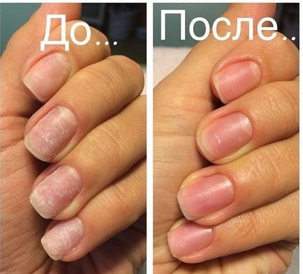 Fito nails system засіб для зміцнення нігтів