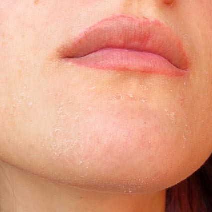 Gelcolic peeling anti-îmbătrânire