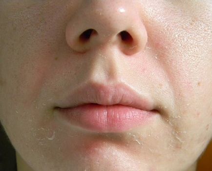 Gelcolic peeling anti-îmbătrânire