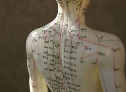Acupunctura cu o hernie de revizii lombare a coloanei vertebrale