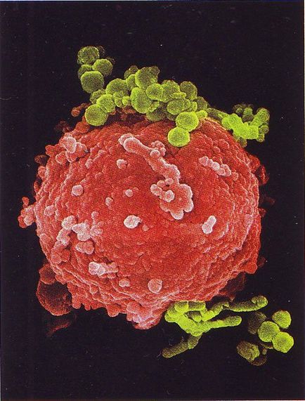 Az immunrendszer a fotókon