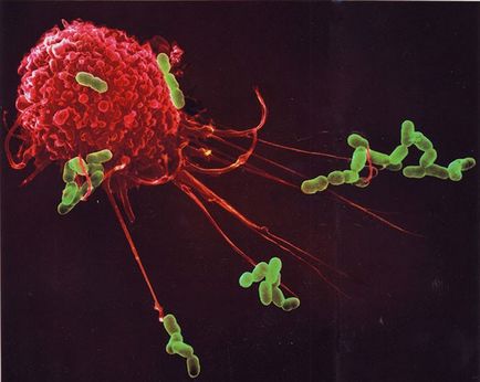 Sistemul imunitar în fotografii