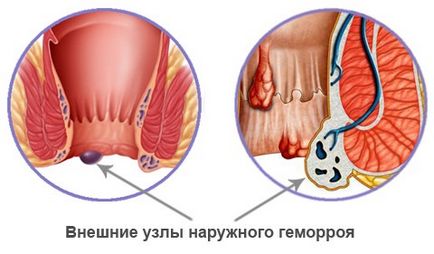 Cum se face un masaj de prostată într-o policlinică și cine are nevoie de ea