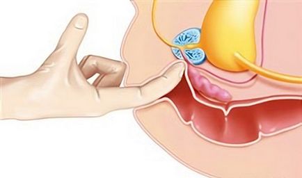 Cum se face un masaj de prostată într-o policlinică și cine are nevoie de ea