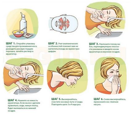 Як правильно проводити промивання носа при гаймориті