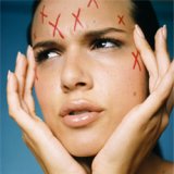 Cum de a vindeca iritarea pielii Roșeața - Doctorul tău Aibolit