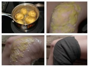 Cartofi cu proprietăți de artroză și metode de aplicare