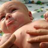 Boli de piele ale nou-născuților - bisturiu - informații medicale și portal educațional