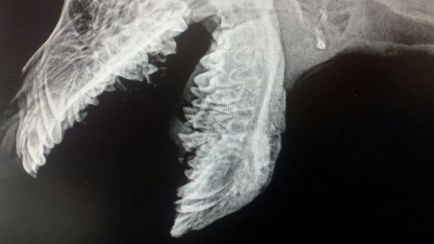 Craniomandibular csontkovácsolás - klinikai esetek - orvosával