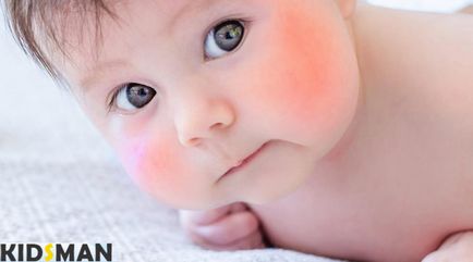 Vörös arca csecsemők okok és a kezelés