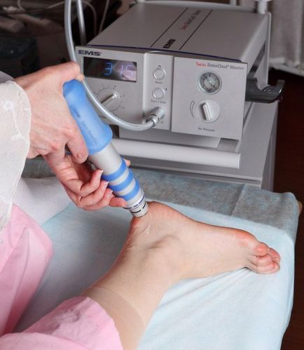 Kezelése saroksarkantyúk 1 (arthrosis boka) Kezelése saroksarkantyúk 1