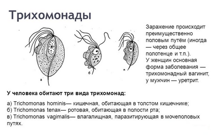 Tratamentul trichomoniei cu remedii folclorice la domiciliu, iarbă, metronidazol