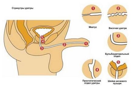 Masajul uretrei pe buzunarul unui bărbat, un centru medical 