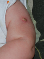 Nu există nici o urmă de vaccinare btszh sau mantu la copil - ce înseamnă aceasta