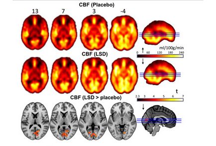 Neuroștii au observat influența psihedelicii asupra științei și tehnologiei celulelor nervoase