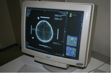 Centrul neurochirurgical (în detaliu)