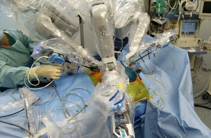 Transzplantáció eltávolítása a hasnyálmirigy, video, átültetett ott, ha transzplantációs