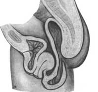 Опущення шийки матки лікування і симптоми - ваша медична енциклопедія