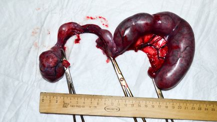 Pyometra, ciszták, daganatok - ezért az ötlet végző piruett (tumor) Pyometra, ciszták, daganatok - ezért az ötlet teljesítő piruett