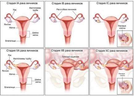 Întârzierea menopauzei la femeile cu simptome și tratament